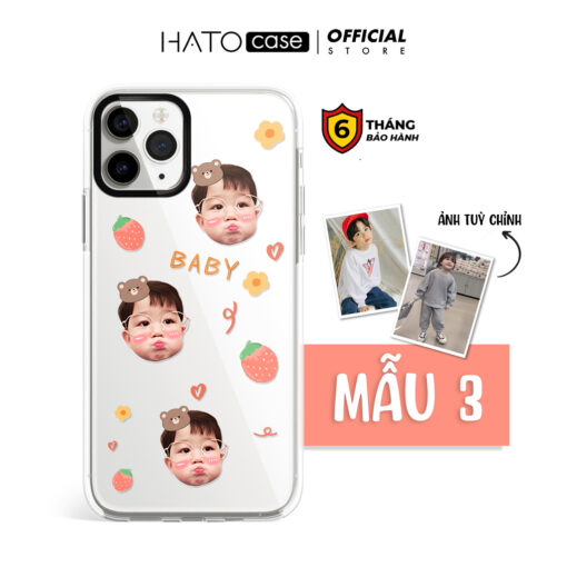 Ốp lưng em bé sticker 02 | Tất cả dòng điện thoại - Image 2