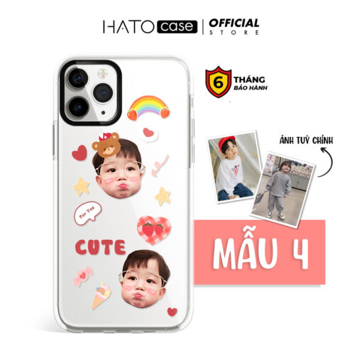 Ốp lưng em bé sticker 02 | Tất cả dòng điện thoại - Image 3
