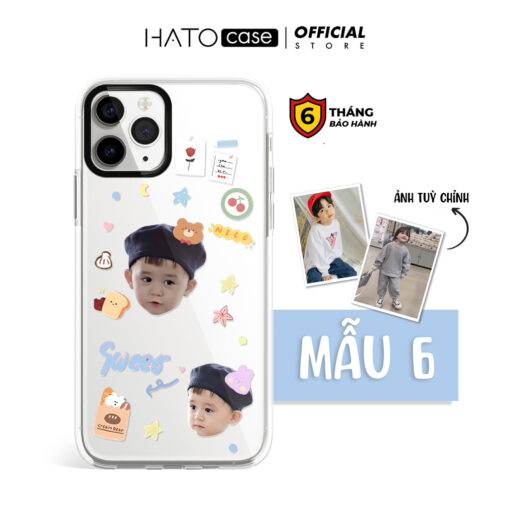 Ốp lưng em bé sticker 03 | Tất cả dòng điện thoại - Image 3
